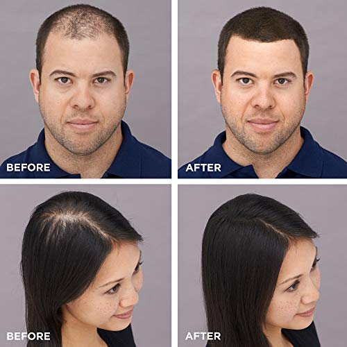 Toppik Hair Building Fibers, Medium Brown, 3g Fill In Fine or Thinning Hair, Instantly Thicker, Fuller Looking, 9 Shades for Men & Women, Keratin Protein Formula