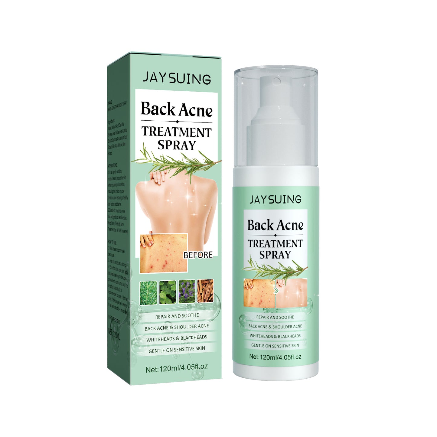 Jaysuing Back Acne Repair Spray, Repair Body Acne Fade Acne Mark Skin Care Spray