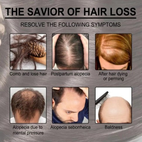 Rosemary Hair Care Essential Oil