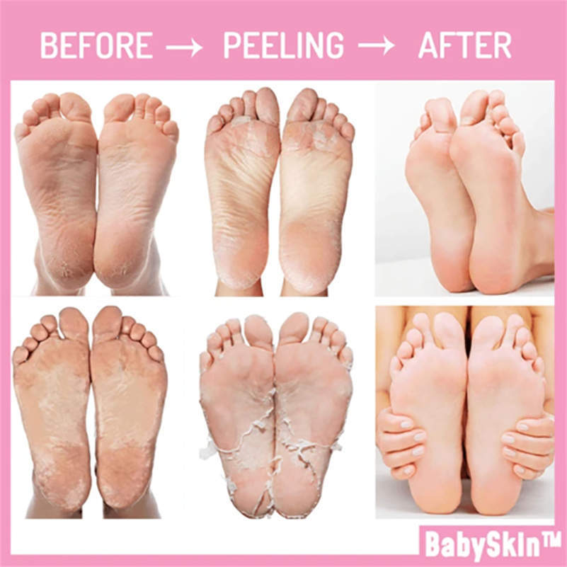 BabySkin Original Peeling Mask - Original Quality