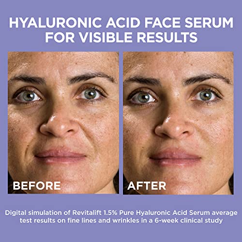L'Oreal Paris Revitalift 1.5% Pure Hyaluronic Acid Face Serum 1.0 oz + True Match Lumi Glotion Natural Glow Enhancer Lotion, Medium 1.35 fl. oz, 1 kit