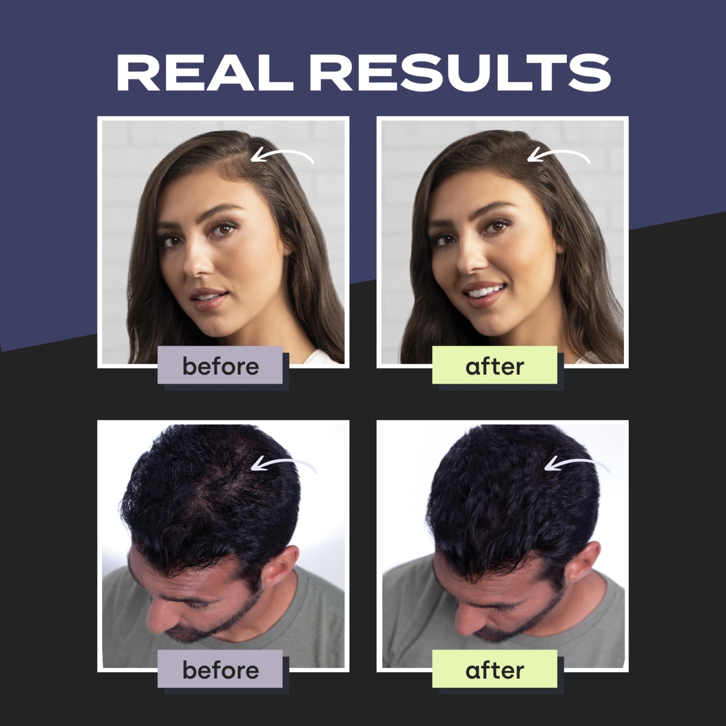 Toppik Hair Building Fibers, Medium Blonde, 12g Fill In Fine or Thinning Hair, Instantly Thicker, Fuller Looking, 9 Shades for Men & Women, Keratin Protein Formula