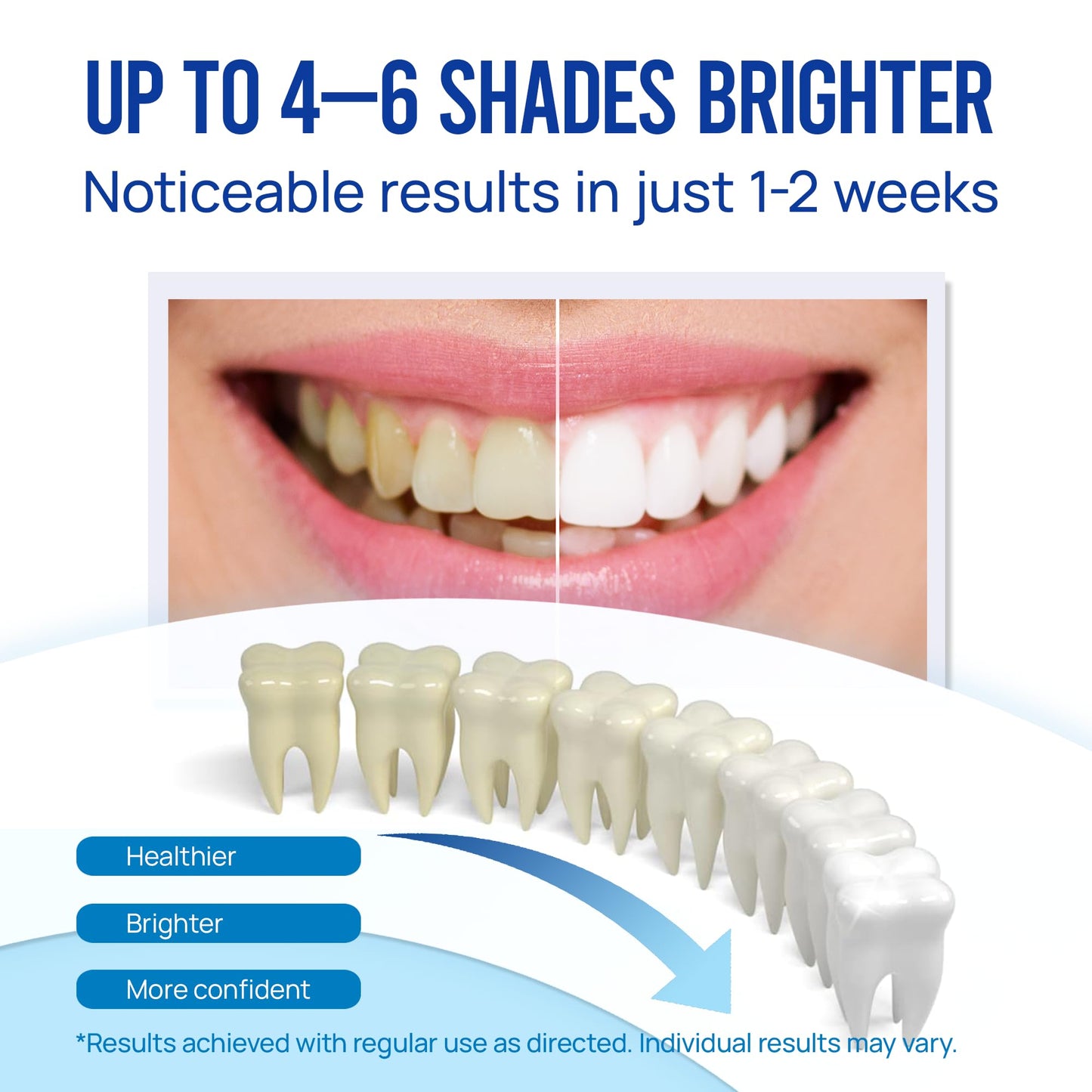 Teeth Whitening Pen Gel Kit: 35% Carbamide Peroxide Gel for Stain Removal - No Sensitivity with Remineralizing Pen for a Brighter Whiter Smile Mild Mint (7 Pack)
