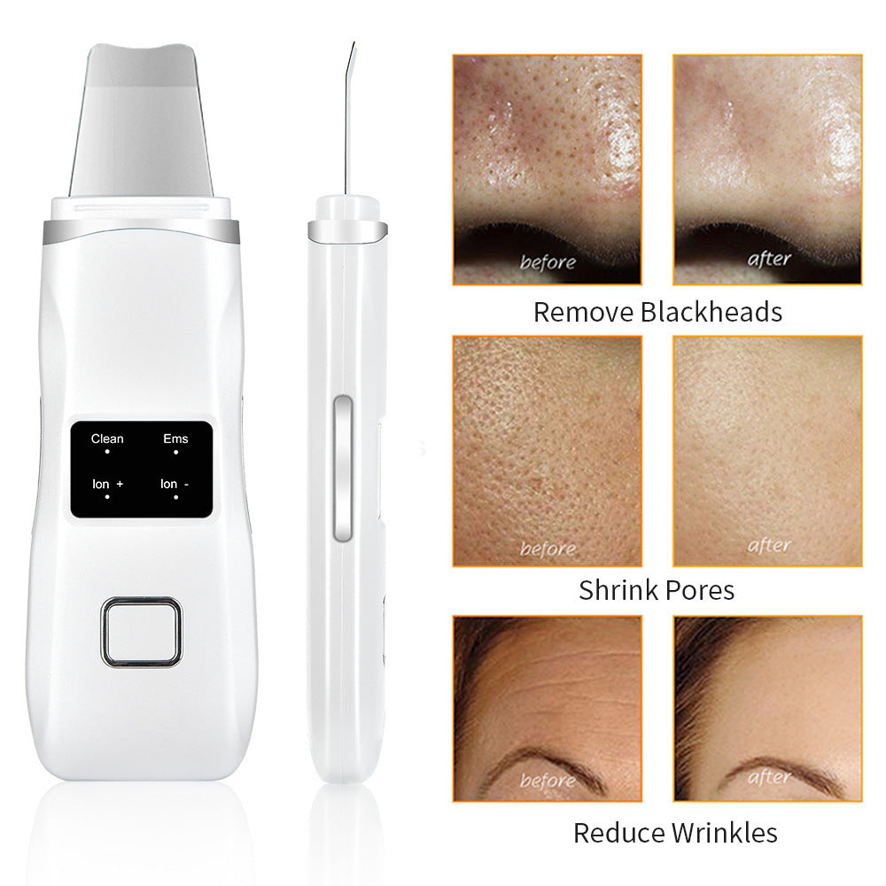 Vibration Massage Introduction Instrument Cleans Pores And Acne Beauty