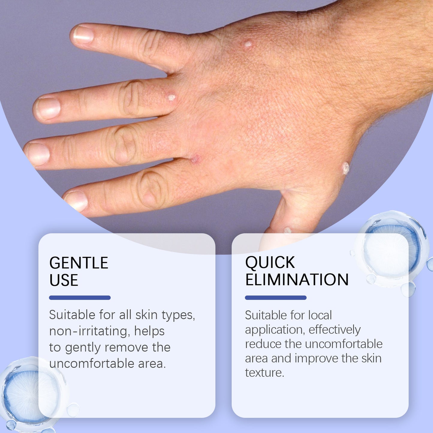 Skin Repair Series Body Gentle Cleaning Repair Smooth Skin Hand And Foot Keyou Care